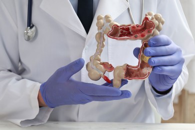 Photo of Doctor with model of large intestine at white table indoors, closeup