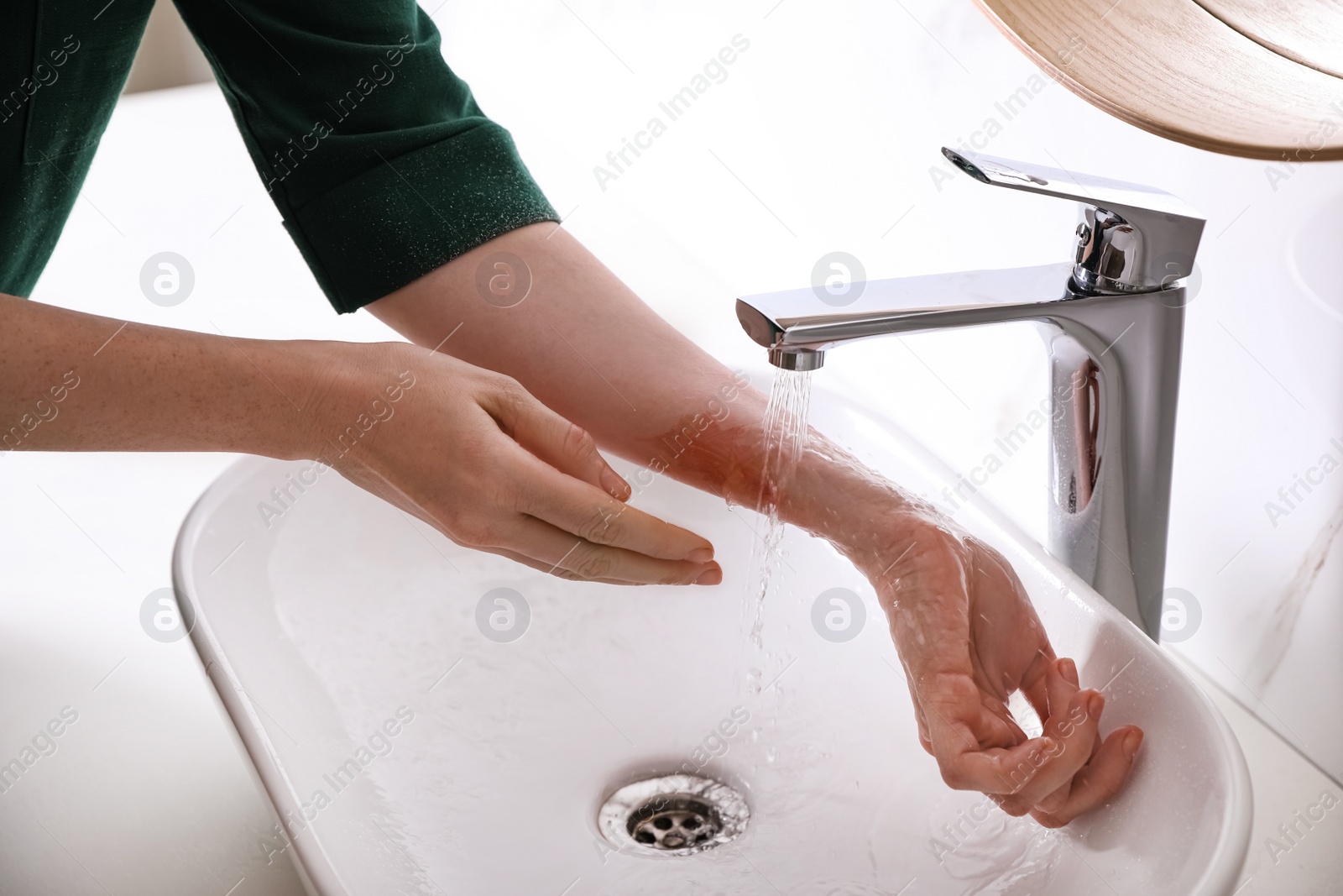 Photo of Woman putting burned hand under running cold water indoors, closeup