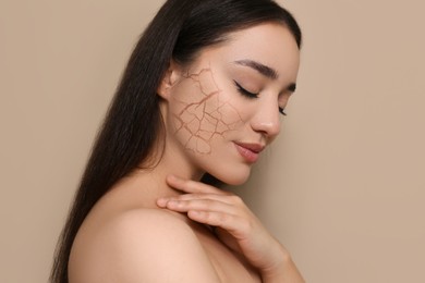 Image of Beautiful young woman with dry skin on beige background