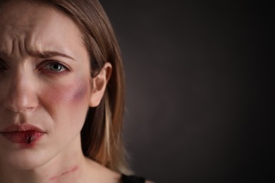 Photo of Closeup view of woman with facial injuries on black background, space for text. Domestic violence victim