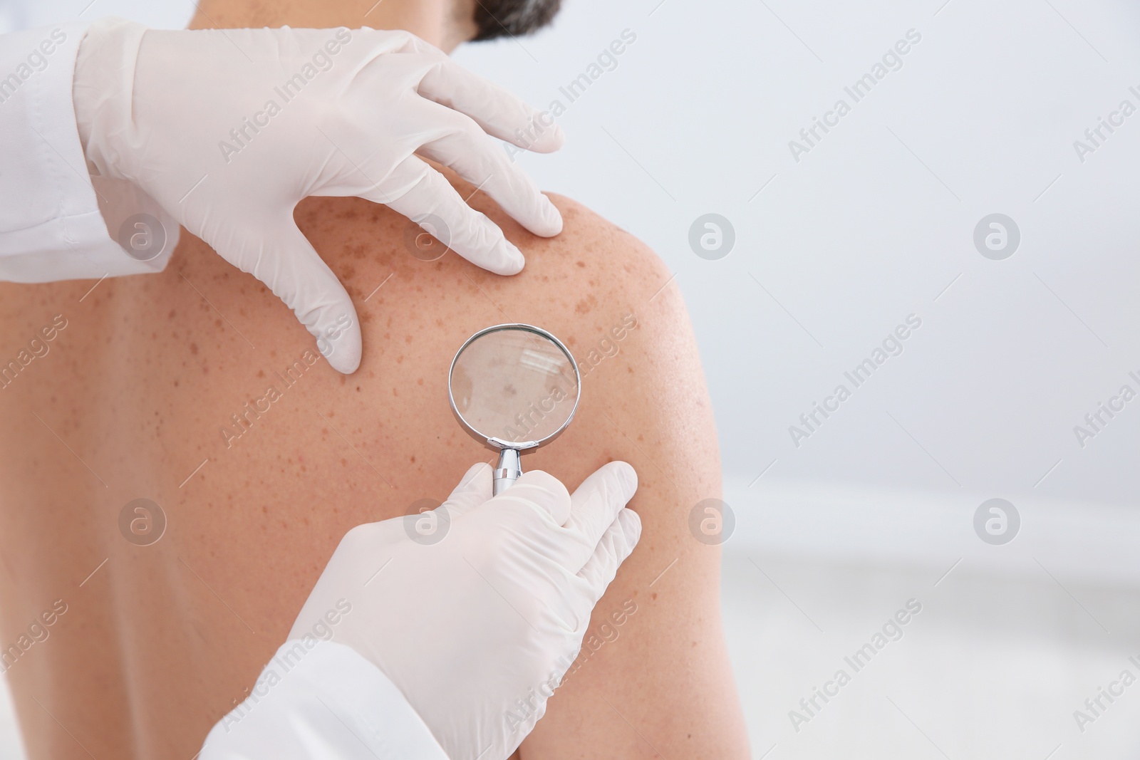 Photo of Dermatologist examining patient's birthmark with magnifying glass in clinic, closeup. Space for text