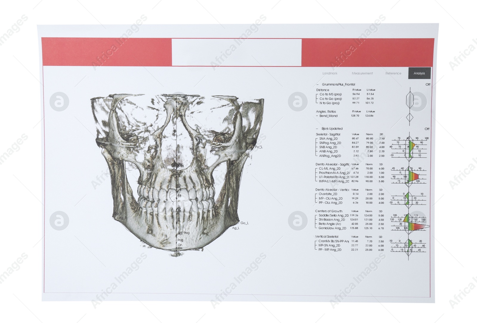Photo of Visualization of human maxillofacial section for dental analysis printed on paper isolated on white