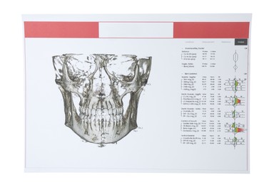 Visualization of human maxillofacial section for dental analysis printed on paper isolated on white