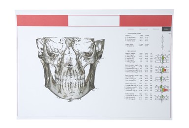 Photo of Visualization of human maxillofacial section for dental analysis printed on paper isolated on white