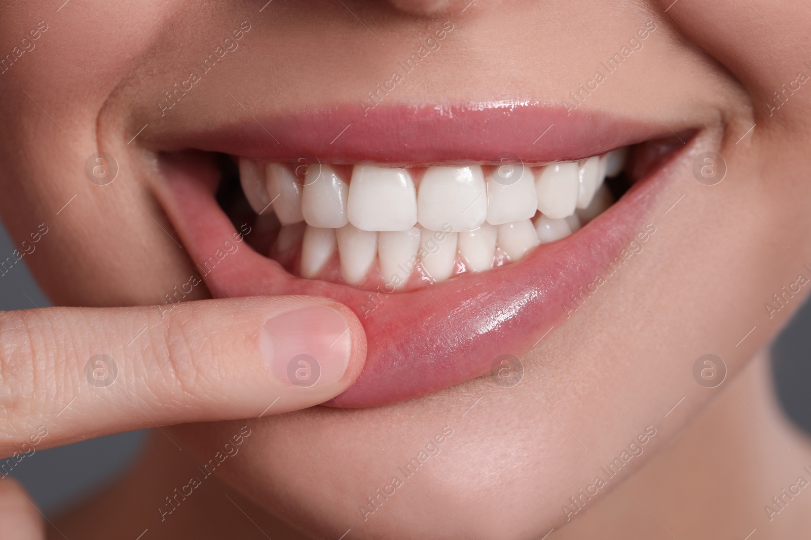 Photo of Young woman showing healthy gums, closeup view