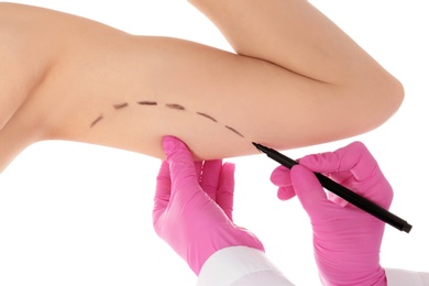 Photo of Doctor drawing marks on woman's arm against white background. Cosmetic surgery
