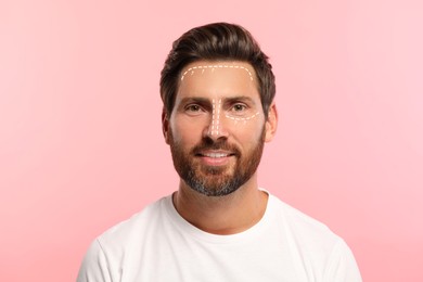 Image of Man with markings for cosmetic surgery on his face against pink background