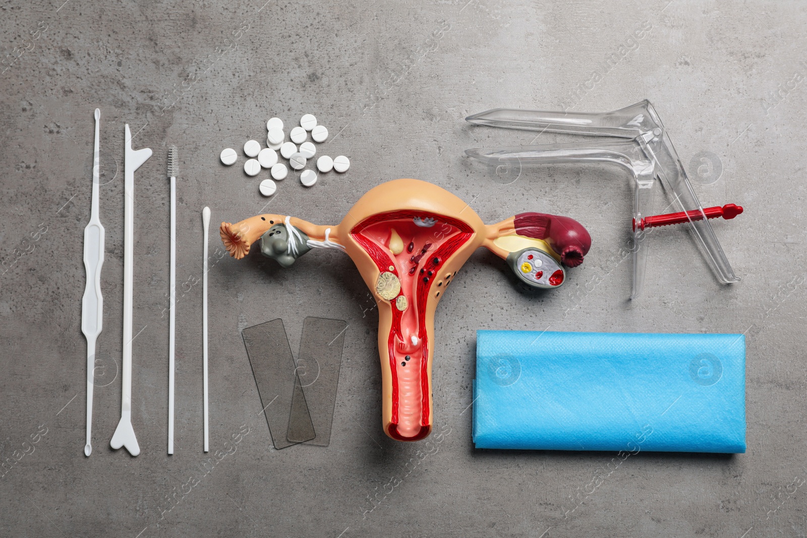 Photo of Gynecological examination kit on grey table, flat lay