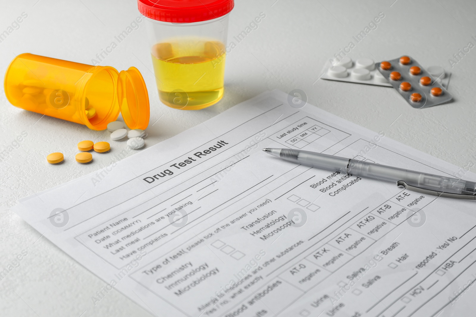 Photo of Drug test result form, container with urine sample and pills on light table