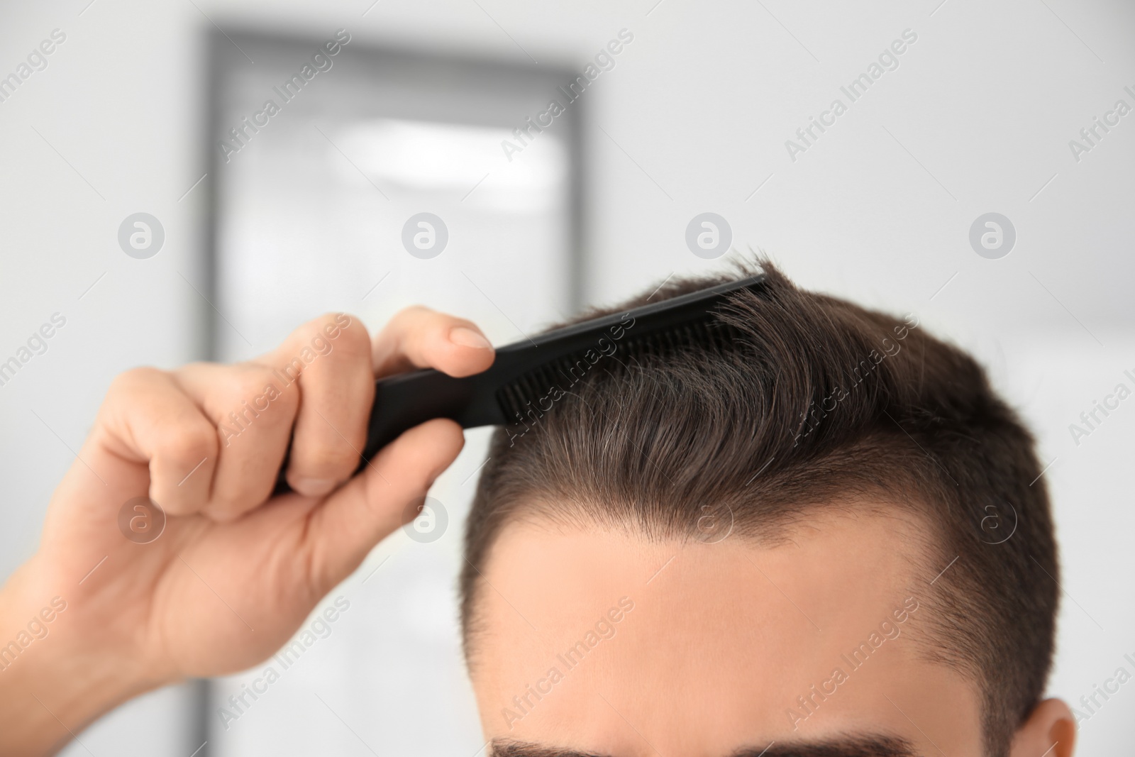 Photo of Young man with hair loss problem indoors