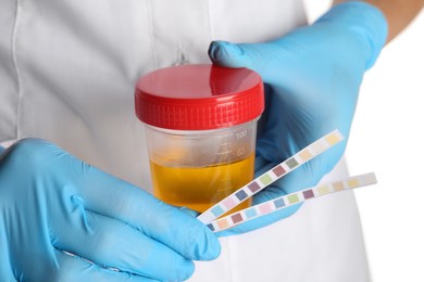 Nurse holding test strips and container with urine sample for analysis on white background, closeup