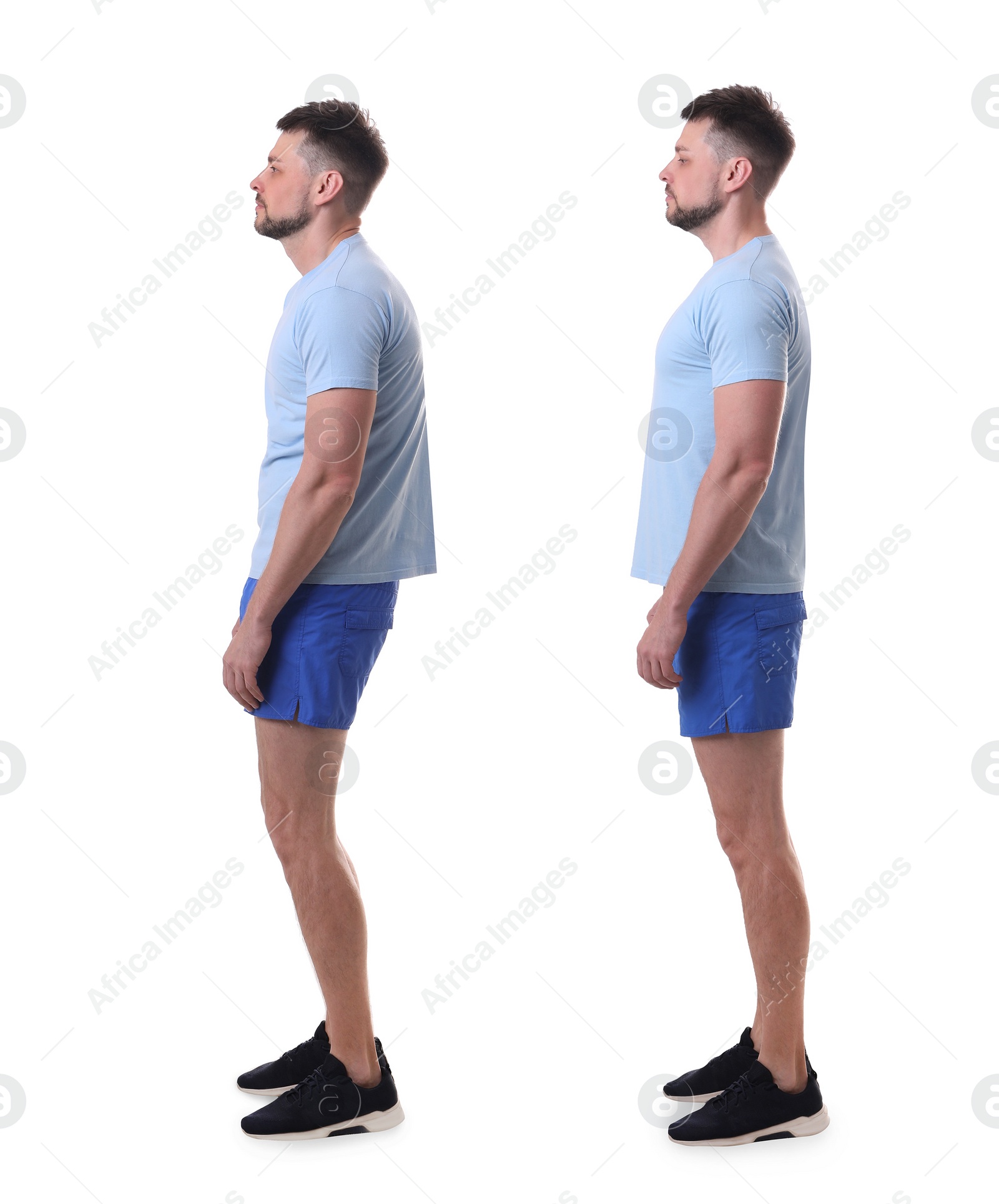 Image of Collage with photos of man with poor and good posture on white background