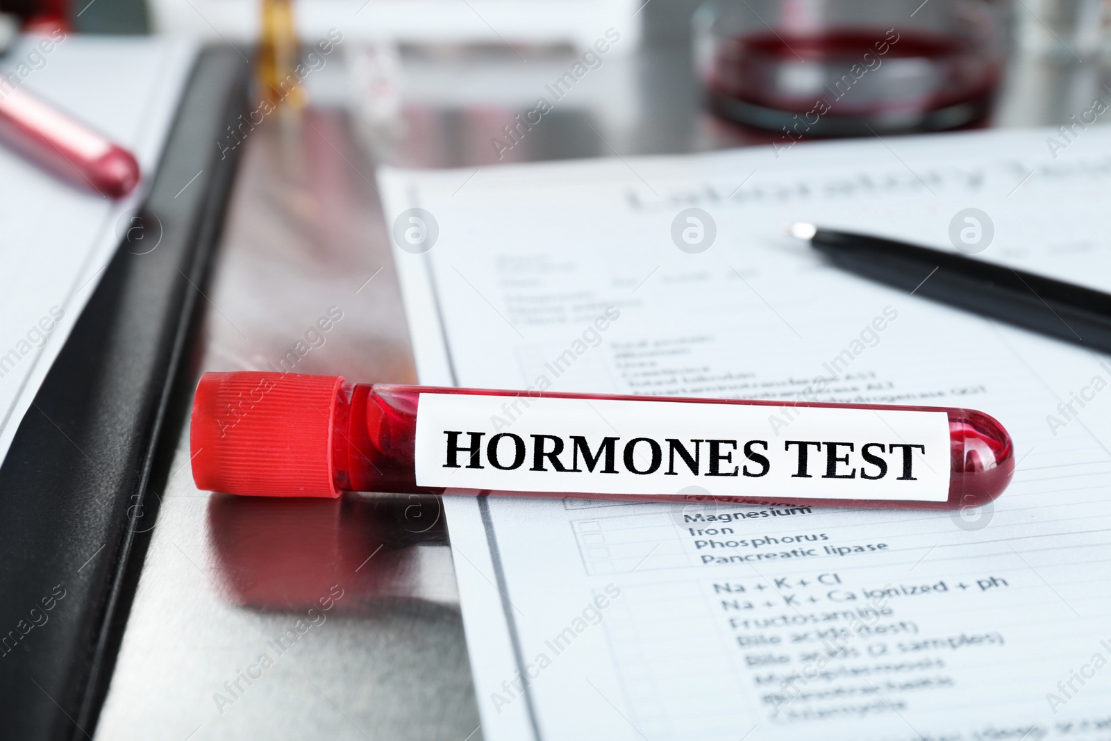 Photo of Glass tube with blood sample and label Hormone Test on metal table