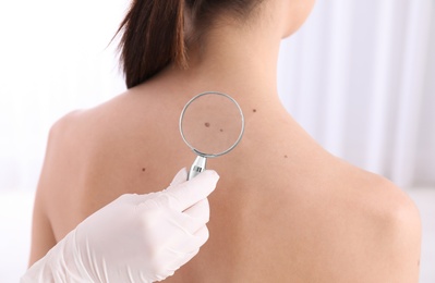 Dermatologist examining patient with magnifying glass in clinic, closeup view