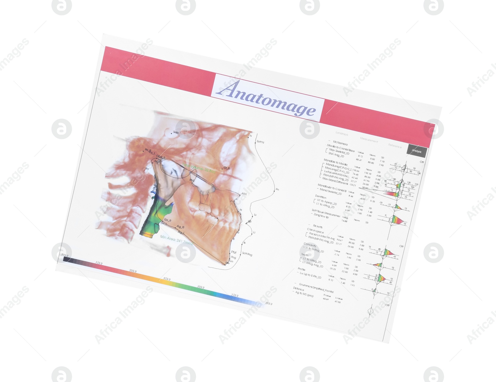 Photo of Visualization of human maxillofacial section for dental analysis printed on paper isolated on white