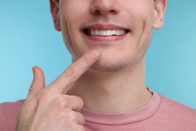 Photo of Young man showing his teeth with whitening strip on light blue background, closeup