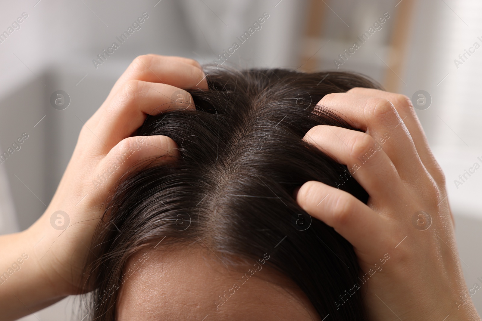 Photo of Woman examining her hair and scalp on blurred background, closeup