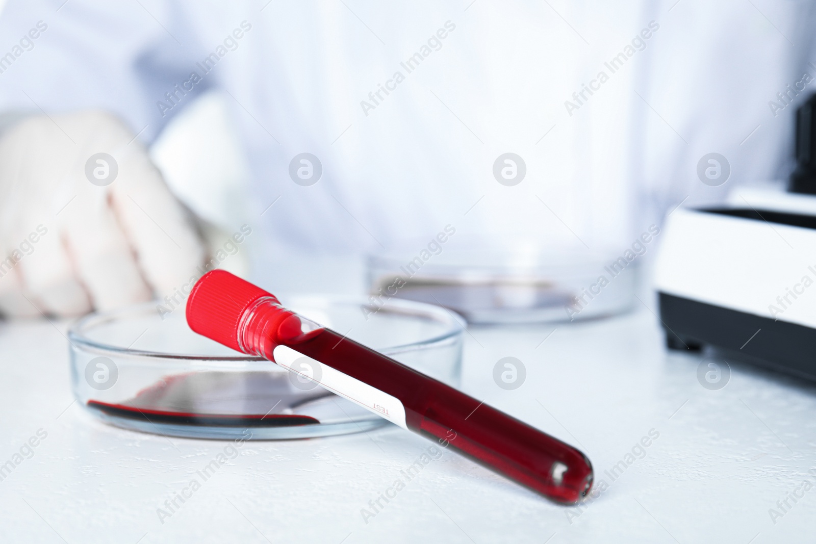 Photo of Scientist working in laboratory, focus on test tube and Petri dish with blood samples. Virus research