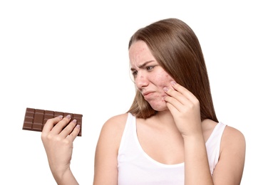 Young woman with acne problem holding chocolate bar on white background. Skin allergy