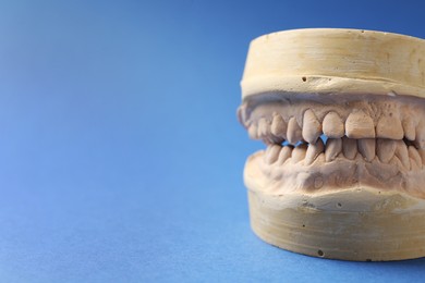 Dental model with gums on blue background, closeup and space for text. Cast of teeth