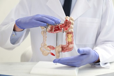 Photo of Doctor with model of large intestine at white table, closeup