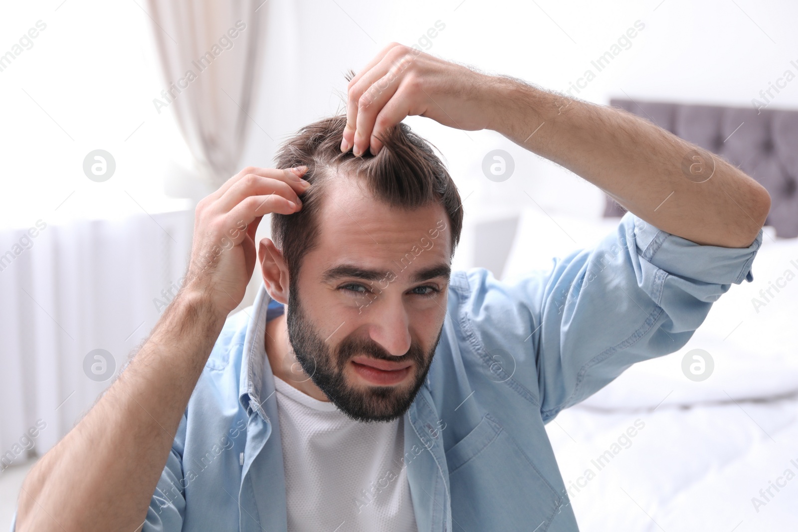 Photo of Young man with hair loss problem indoors