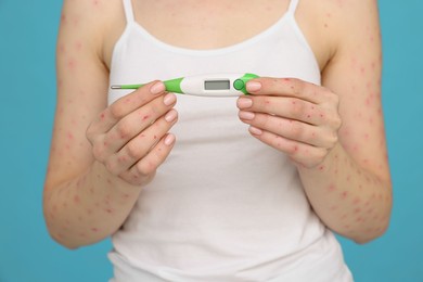 Woman with rash holding thermometer on light blue background, closeup. Monkeypox virus