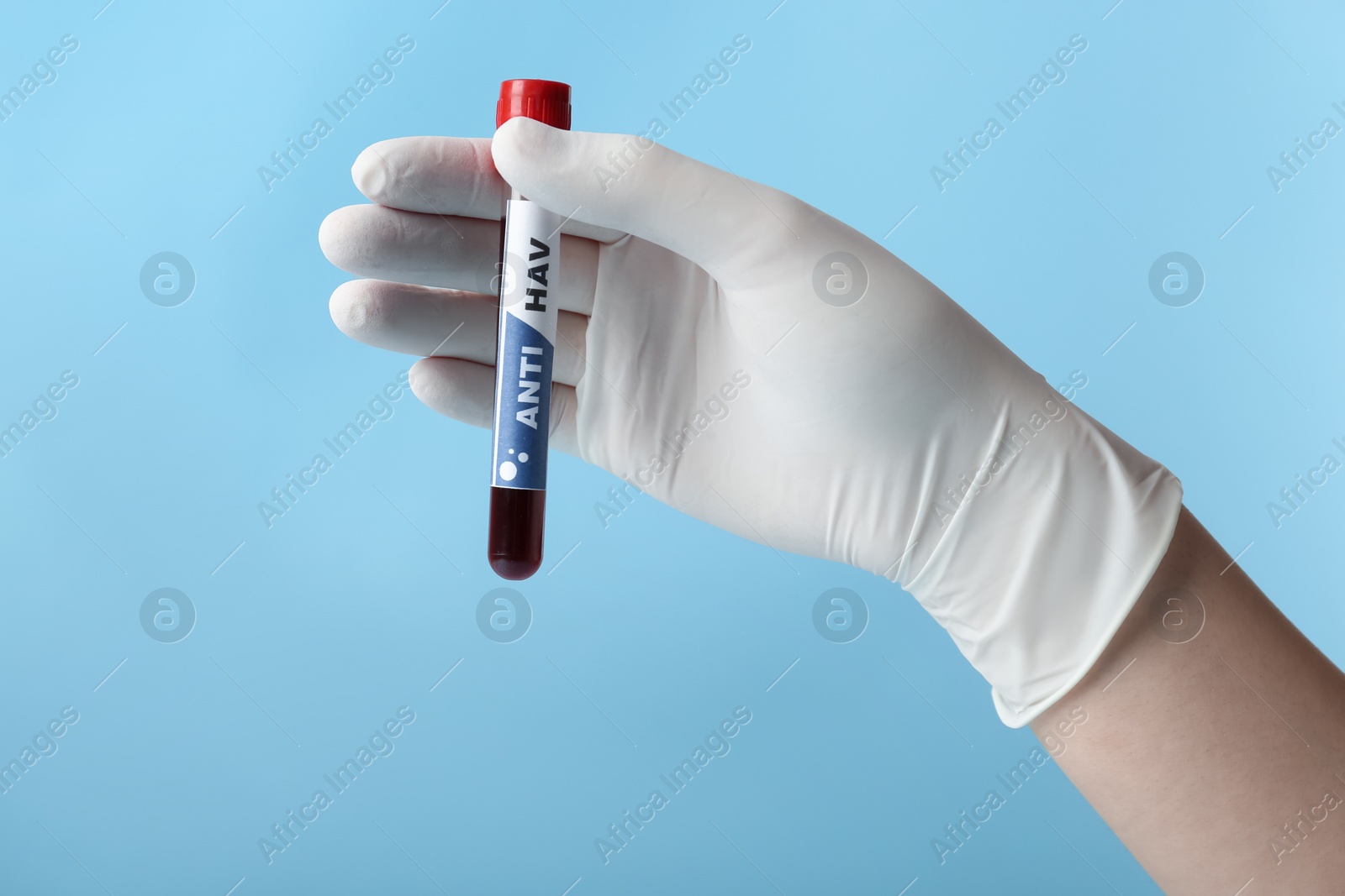 Photo of Scientist holding tube with blood sample and label Anti HAV on light blue background, closeup