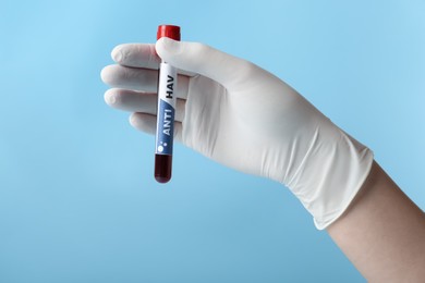 Scientist holding tube with blood sample and label Anti HAV on light blue background, closeup