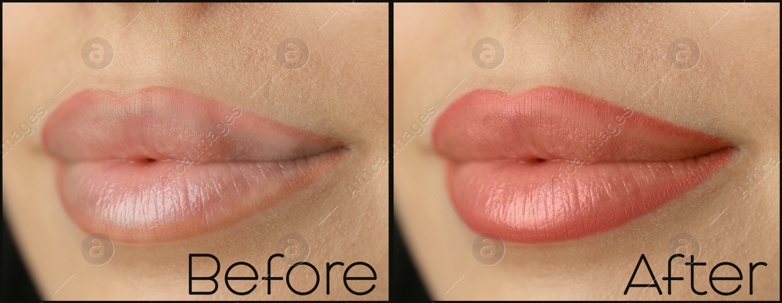 Image of Collage with photos of young woman before and after permanent lip makeup, closeup. Banner design