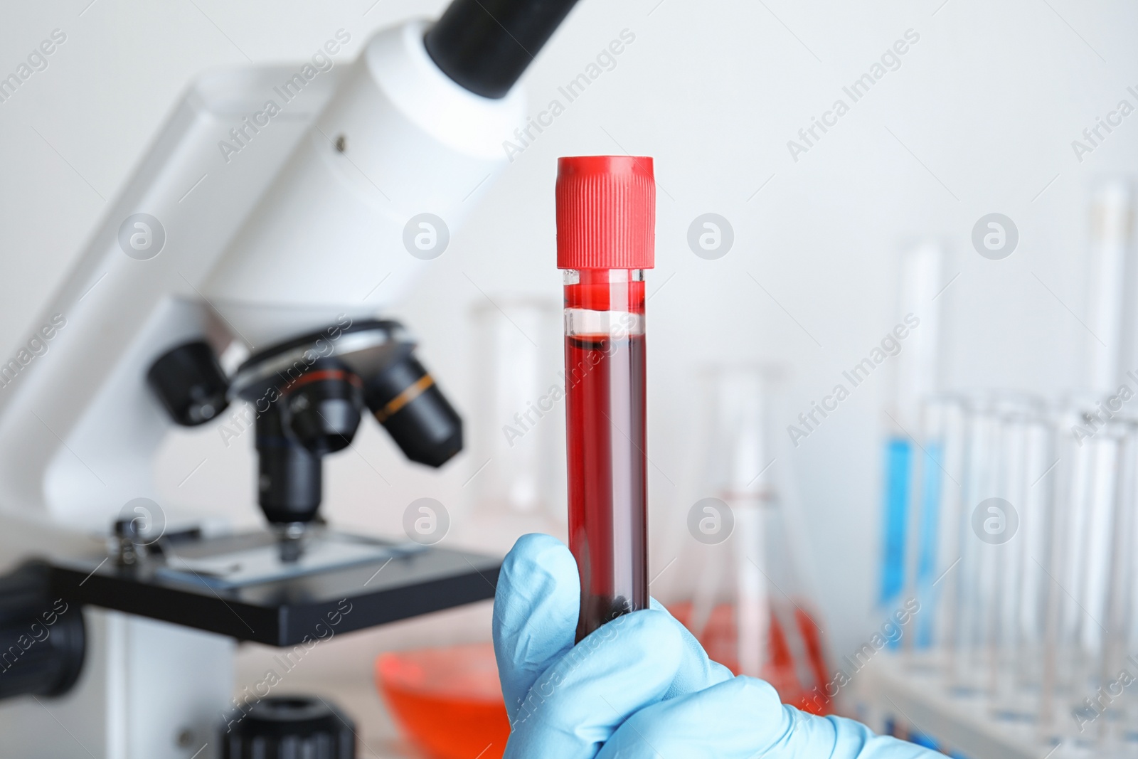 Image of Scientist holding test tube with blood sample near microscope, closeup. Laboratory analysis
