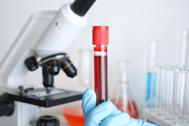 Scientist holding test tube with blood sample near microscope, closeup. Laboratory analysis