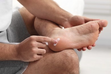 Photo of Man with dry skin applying cream onto his foot on light background, closeup