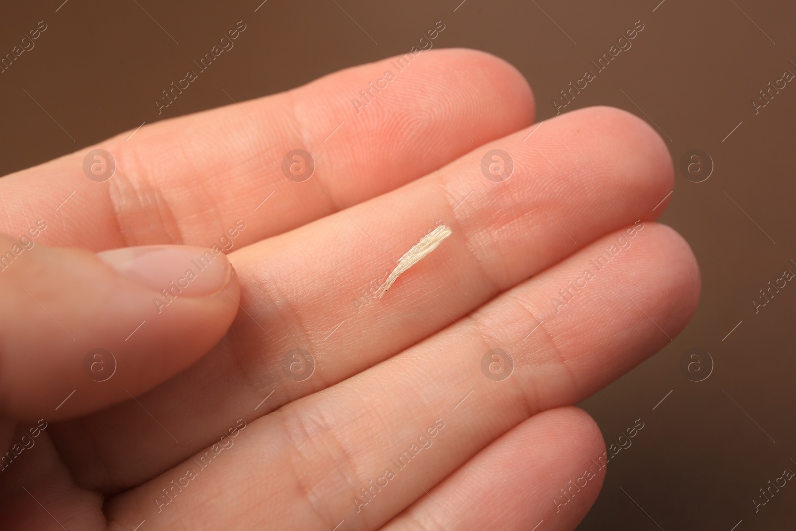 Photo of Woman with splinter in her hand on brown background, closeup