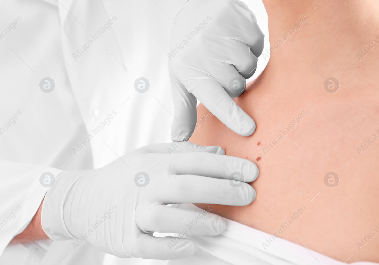 Photo of Dermatologist examining patient in clinic, closeup view