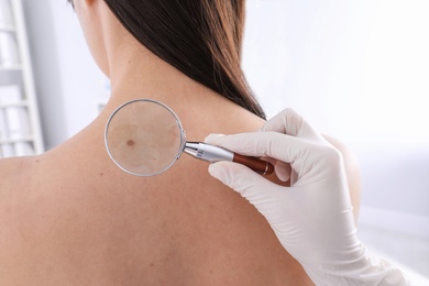 Photo of Dermatologist examining patient with magnifying glass in clinic, closeup view