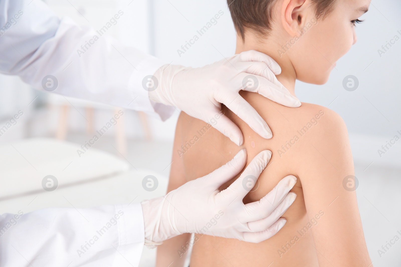 Photo of Dermatologist examining little boy's birthmark in clinic