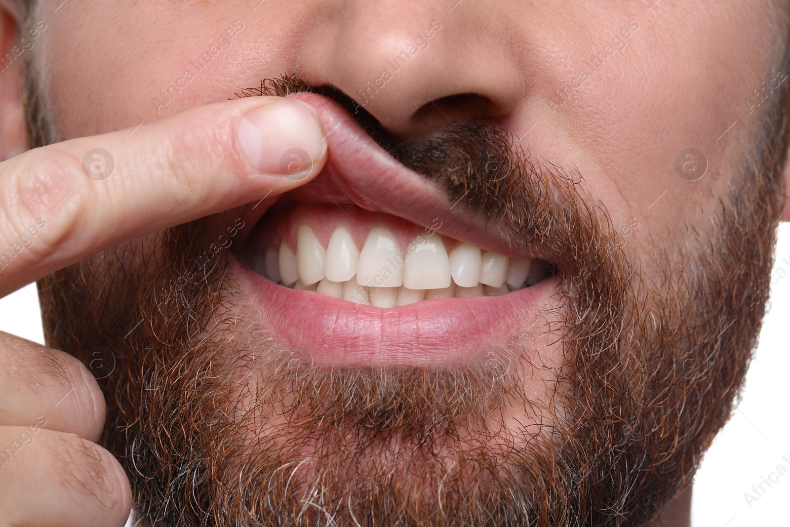 Photo of Man showing healthy gums on white background, closeup