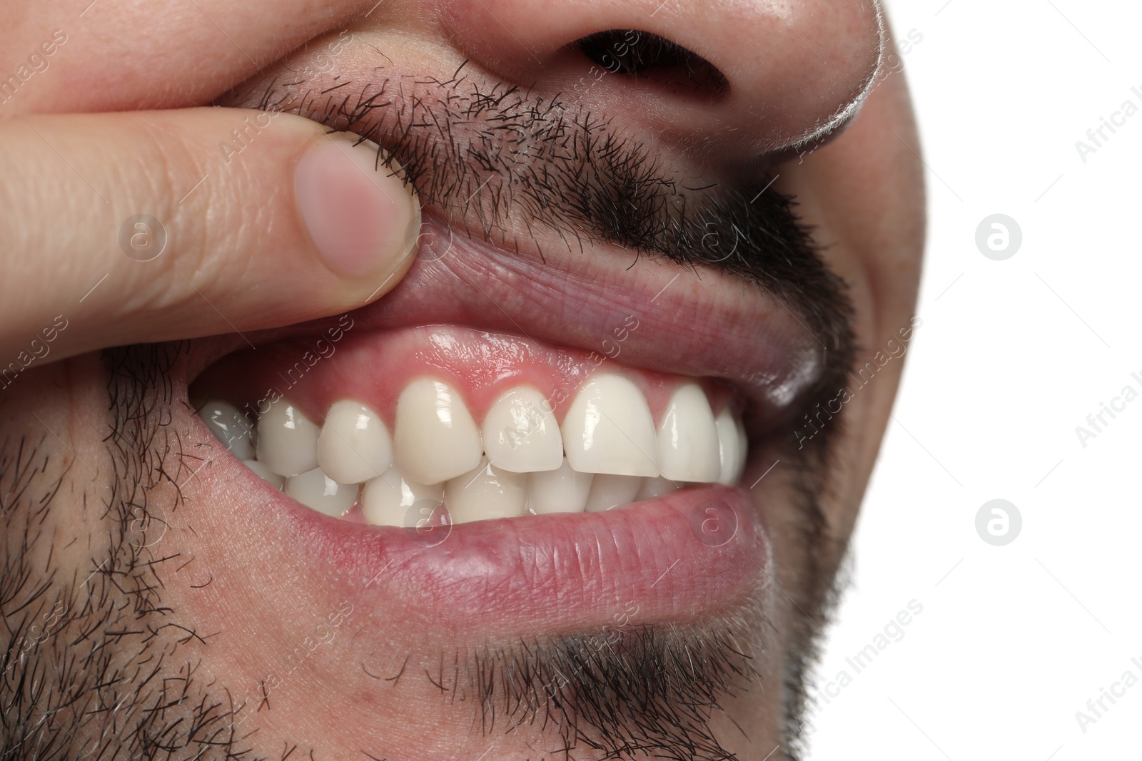 Photo of Man showing healthy gums on white background, closeup