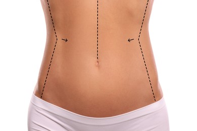 Image of Woman with markings for cosmetic surgery on her abdomen against white background, closeup