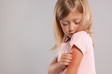 Photo of Suffering from allergy. Little girl scratching her arm on light gray background, space for text