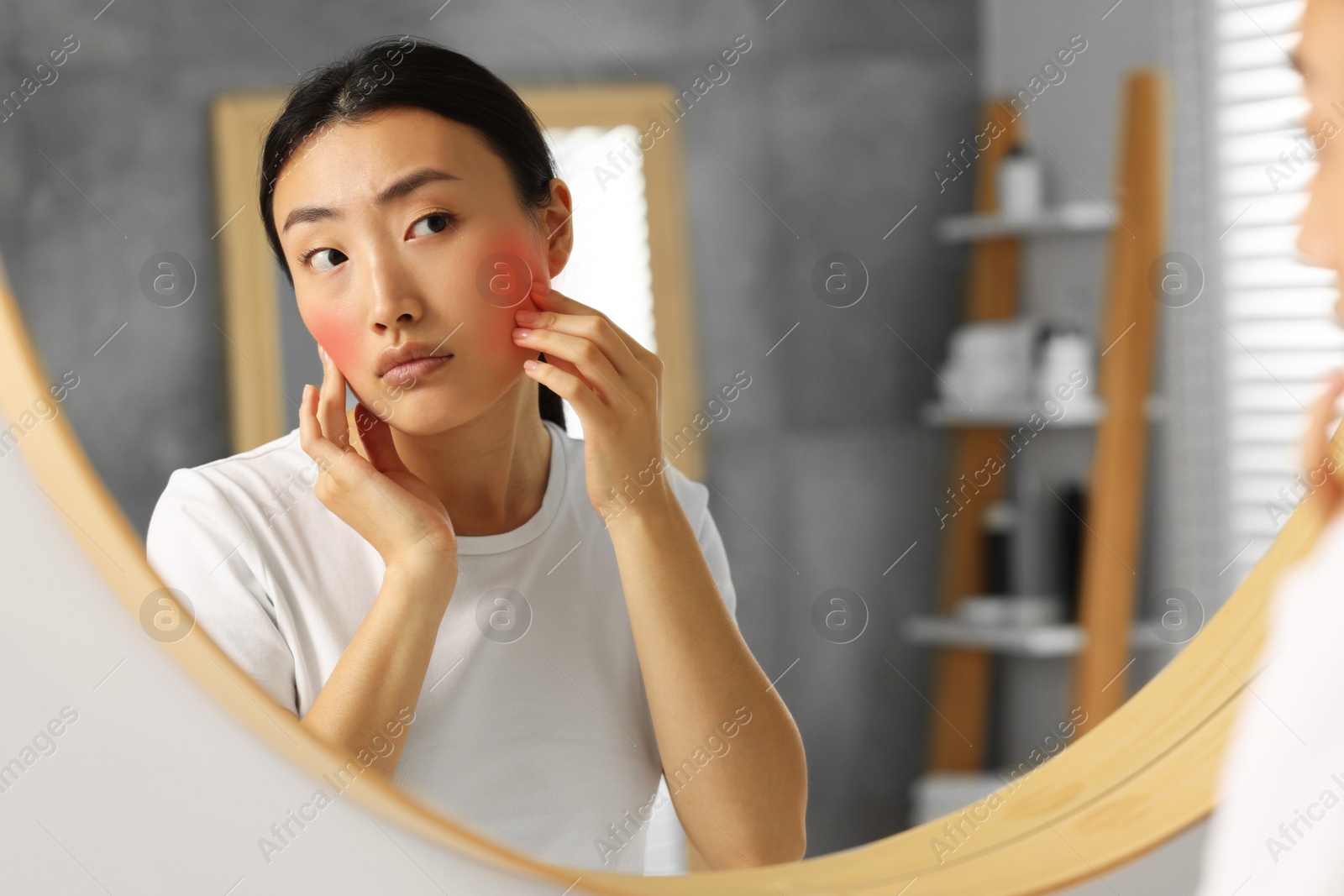 Photo of Suffering from allergy. Young woman checking her face near mirror in bathroom