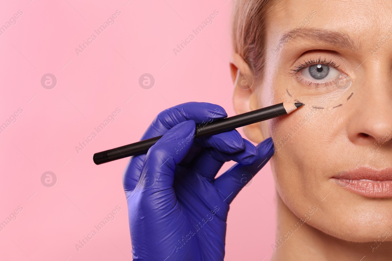 Photo of Doctor with pencil preparing patient for cosmetic surgery operation on pink background, closeup. Space for text