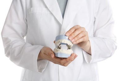 Photo of Doctor holding dental model with jaws on white background, closeup. Cast of teeth