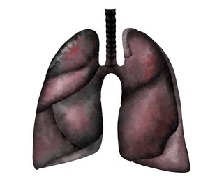 Illustration of  human lungs affected by disease on white background