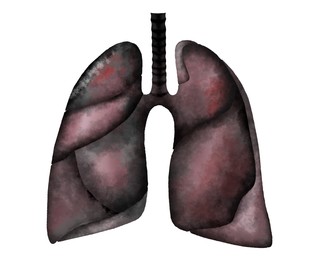 Illustration of human lungs affected by disease on white background