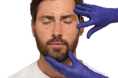 Doctor checking patient's face before cosmetic surgery operation on white background, closeup