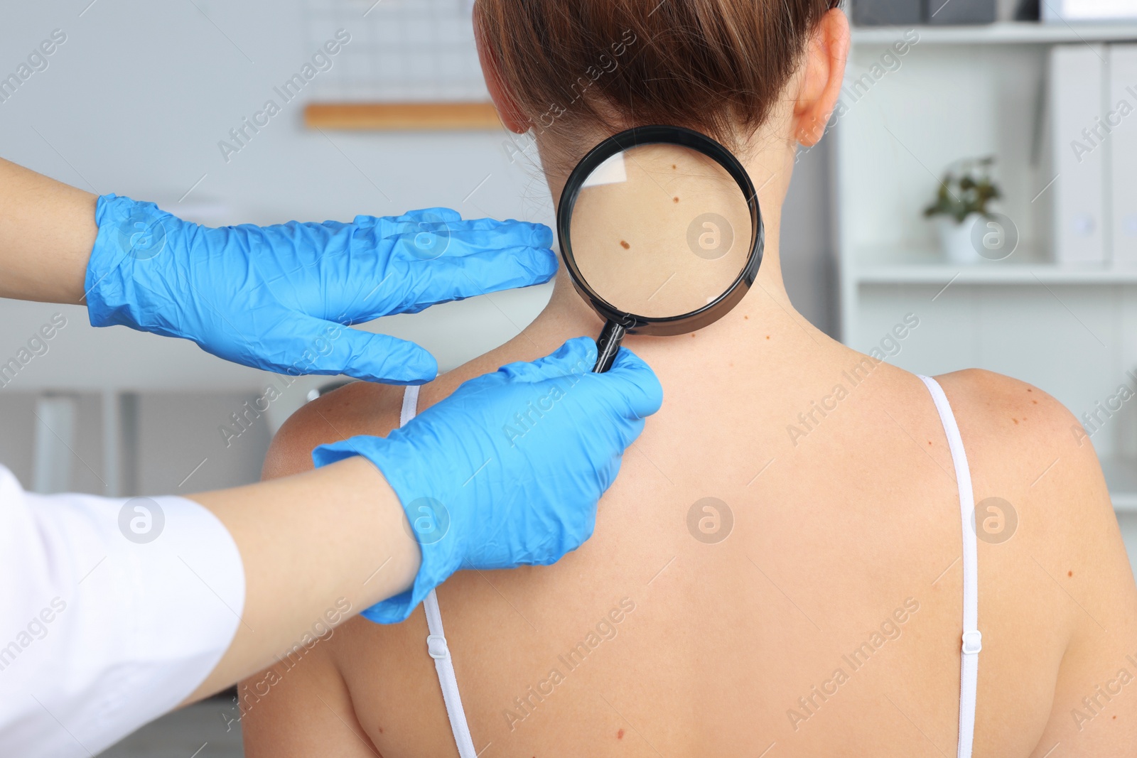 Photo of Dermatologist examining patient's birthmark with magnifying glass in clinic, closeup