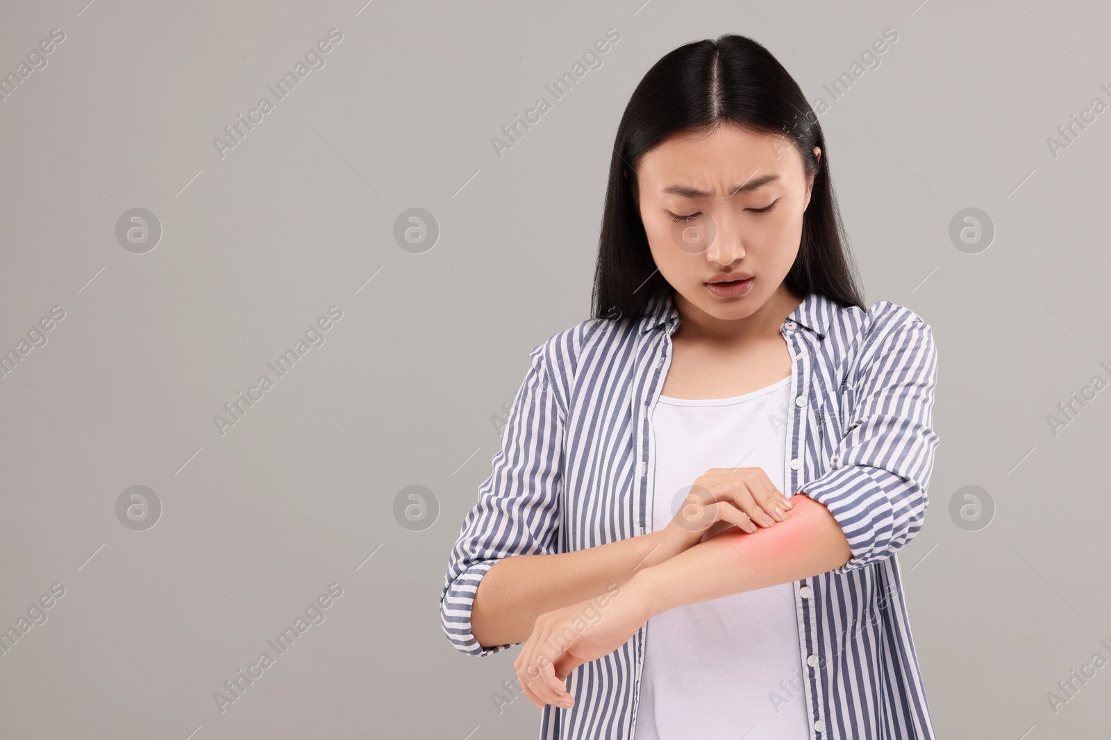 Photo of Suffering from allergy. Young woman scratching her arm on grey background, space for text