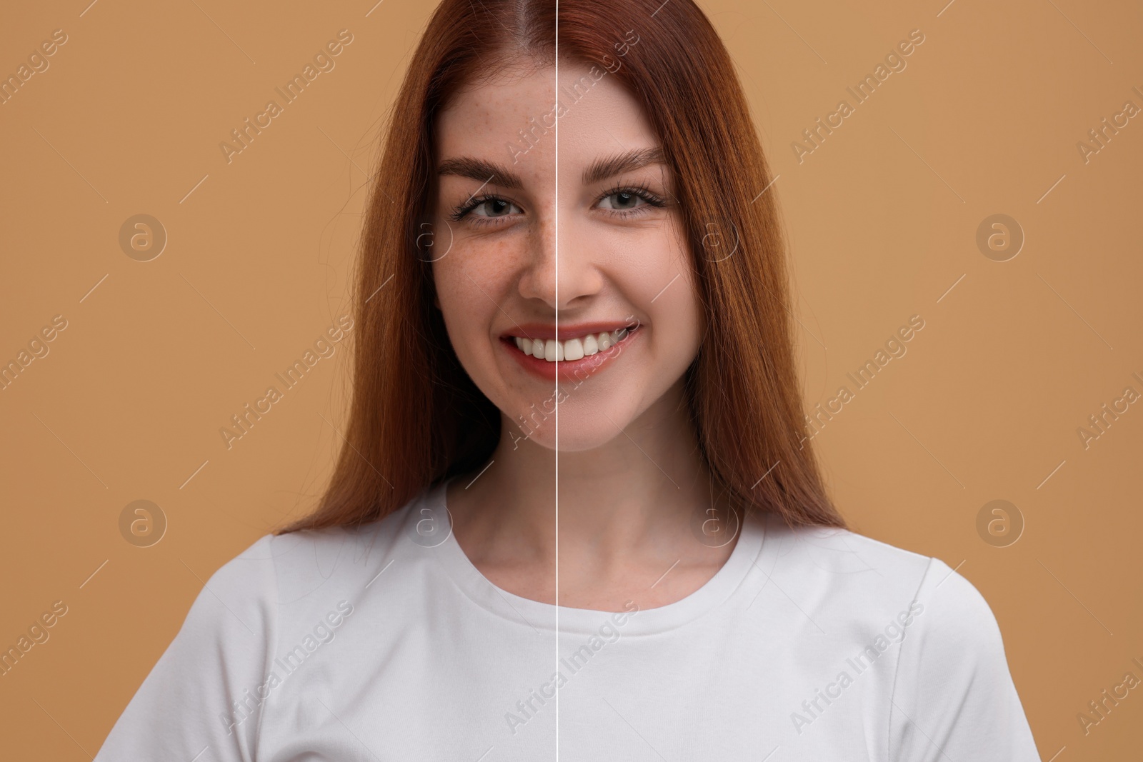 Image of Woman with freckles and clear skin on dark beige background, collage